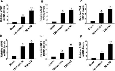 Recombinant <mark class="highlighted">Annexin A2</mark> Administration Improves Neurological Outcomes After Traumatic Brain Injury in Mice